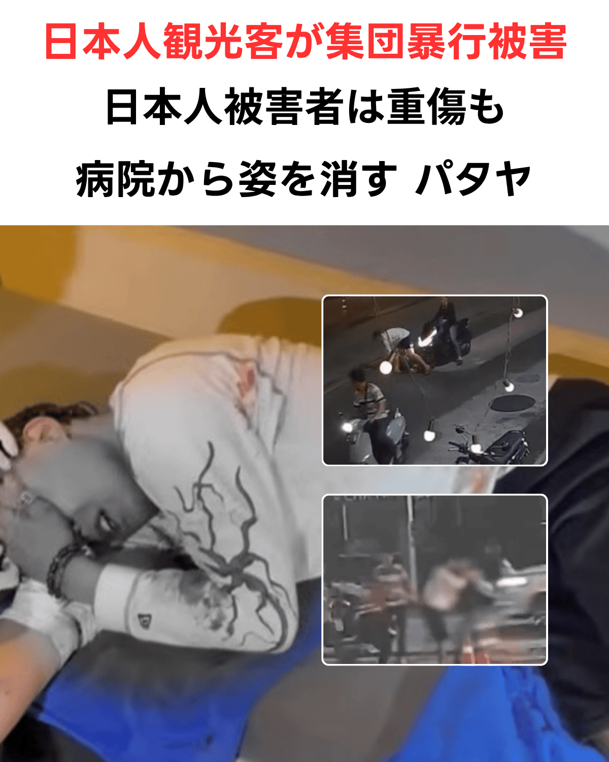 パタヤでの日本人観光客集団暴行事件。救急処置を受ける重傷の日本人男性と、犯行の瞬間（バイクでの追跡・体当たり）を捉えた監視カメラ（CCTV）の静止画。