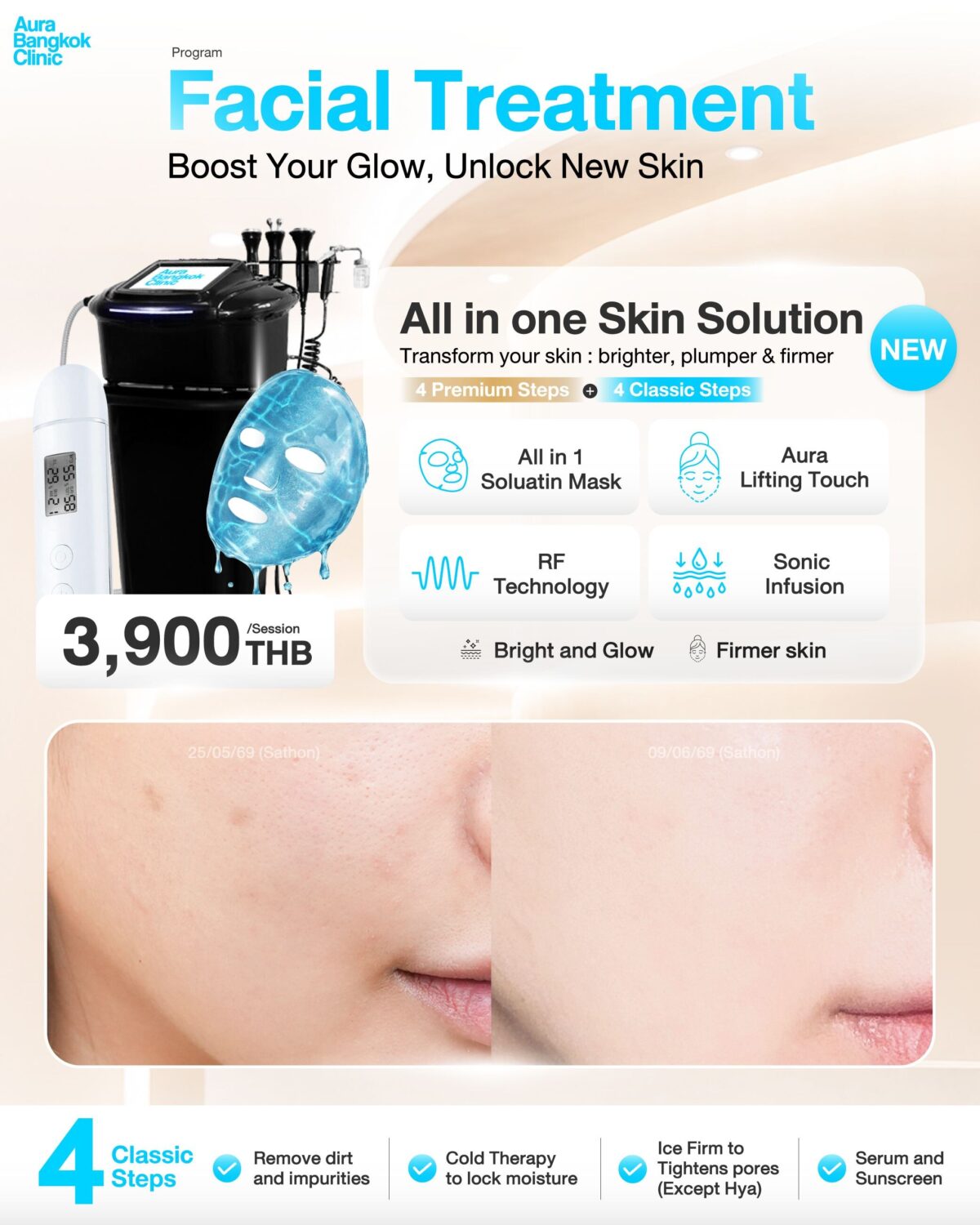 バンコクの美容クリニック「Aura Bangkok Clinic」のフェイシャル施術「All in One Skin Solution」を紹介するプロモーションポスター。3,900バーツの料金表示、専用の施術マシンやマスク、4つのプレミアムステップとクラシックステップの解説、および施術前後の肌の変化を比較した写真が掲載されています。ファイル名:3.jpg
